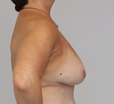 3613-imageset_3-before