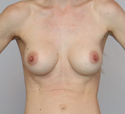3704-imageset_2-before