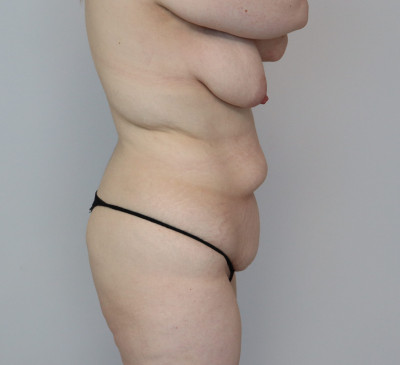3736-imageset_3-before