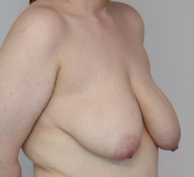 3746-imageset_2-before