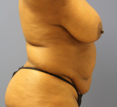3798-imageset_3-before