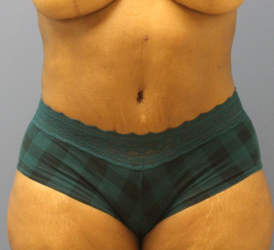 3819-imageset_1-after