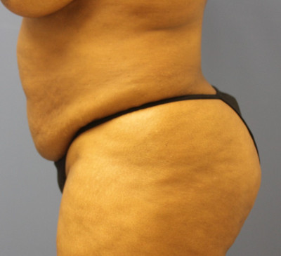 3819-imageset_3-before