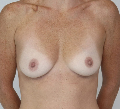 3854-imageset_1-before