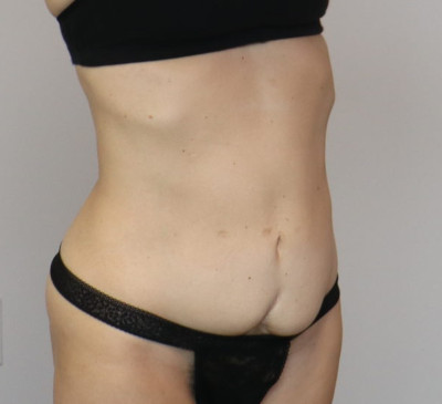 3875-imageset_2-before