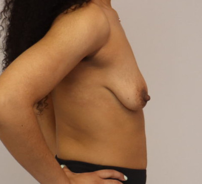 3921-imageset_3-before