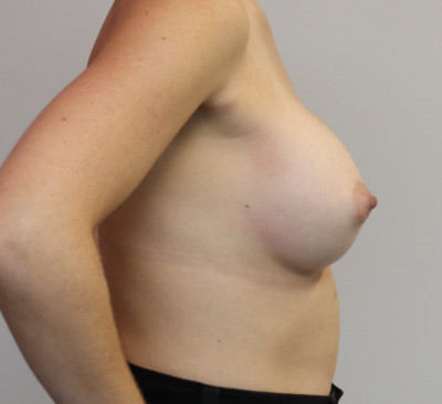 3963-imageset_3-after