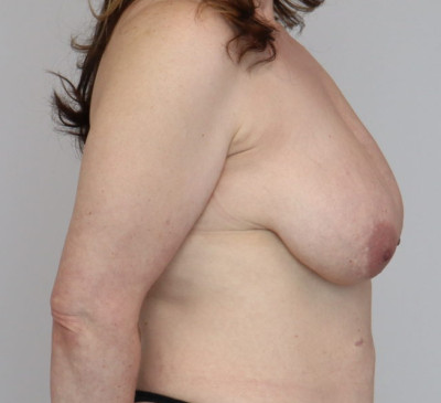 4002-imageset_3-before