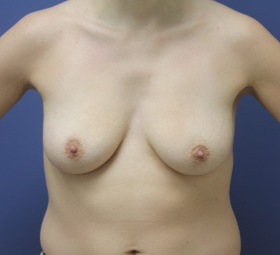4008-imageset_1-before
