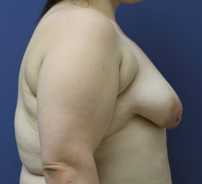 4170-imageset_3-before